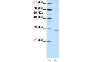 WB Suggested Anti-ATOH8 Antibody Titration:  2. (ATOH8 Antikörper  (N-Term))