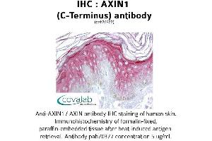 Image no. 1 for anti-Axin 1 (AXIN1) (C-Term) antibody (ABIN1732155) (Axin Antikörper  (C-Term))