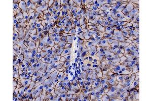 Immunohistochemistry (Paraffin-embedded Sections) (IHC (p)) image for anti-Cadherin 1, Type 1, E-Cadherin (Epithelial) (CDH1) antibody (ABIN7249790)