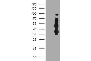 HEK293T cells were transfected with the pCMV6-ENTRY control (Left lane) or pCMV6-ENTRY SERPINB6 (Right lane) cDNA for 48 hrs and lysed. (SERPINB6 Antikörper)