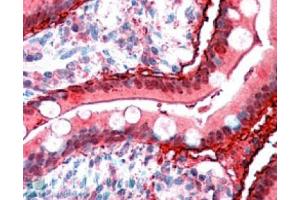 Image no. 1 for anti-Fatty Acid Binding Protein 2, Intestinal (FABP2) (C-Term) antibody (ABIN374817) (FABP2 Antikörper  (C-Term))