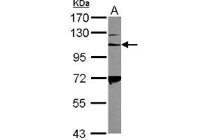 WB Image Sample (30 ug of whole cell lysate) A: K562 7. (Integrin Alpha2b Antikörper  (C-Term))