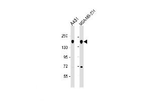 Western Blot at 1:1000 dilution Lane 1: A431 whole cell lysate Lane 2: MDA-MB-231 whole cell lysate Lysates/proteins at 20 ug per lane. (EGF Antikörper  (AA 847-876))