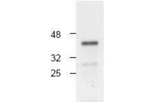 Image no. 1 for anti-Caspase 4, Apoptosis-Related Cysteine Peptidase (CASP4) antibody (ABIN126973) (Caspase 4 Antikörper)