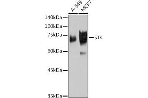 Western blot analysis of extracts of various cell lines, using 5T4 Rabbit mAb (ABIN7271009) at 1:1000 dilution. (TPBG Antikörper)