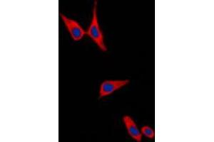 Immunofluorescence (IF) image for anti-Cadherin 1, Type 1, E-Cadherin (Epithelial) (CDH1) (C-Term) antibody (ABIN7295214)