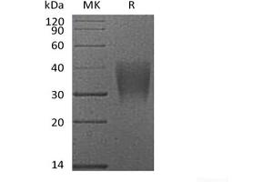 Western Blotting (WB) image for CD28 (CD28) (Active) protein (His tag) (ABIN7319757) (CD28 Protein (CD28) (His tag))