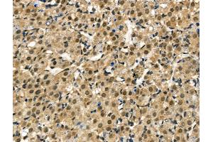 ABIN6260516 and ABIN6267035 at 1/100 staining Rat ovarian tissue by IHC-P. (CBP Antikörper  (C-Term))