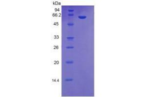 SDS-PAGE analysis of Human MBL2 Protein.