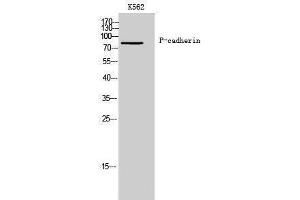 Western Blotting (WB) image for anti-P-Cadherin (CDH3) (N-Term) antibody (ABIN3180797) (P-Cadherin Antikörper  (N-Term))