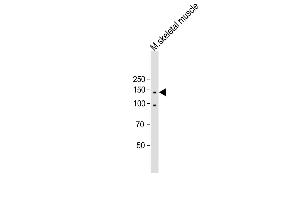 All lanes : Anti-ITGA11 Antibody (N-term) at 1:500 dilution Lane 1: Mouse skeletal muscle lysate Lysates/proteins at 20 μg per lane. (ITGA11 Antikörper  (N-Term))