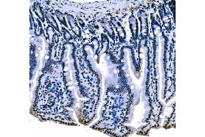 IHC analysis of splicing factor 1 using anti-splicing factor 1 antibody (ABIN7600193).