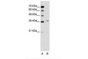 Image no. 1 for anti-Aminolevulinate Dehydratase (ALAD) (AA 91-140) antibody (ABIN6736618)