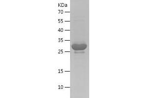 Western Blotting (WB) image for Aquaporin 4 (AQP4) (AA 253-323) protein (His-IF2DI Tag) (ABIN7283414) (Aquaporin 4 Protein (AQP4) (AA 253-323) (His-IF2DI Tag))