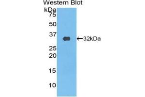 Detection of Recombinant PIK3C2b, Rat using Polyclonal Antibody to Phosphoinositide-3-Kinase Class-2-Beta Polypeptide (PIK3C2b)