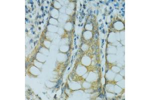 Immunohistochemistry of paraffin-embedded human colon using CYP2B6 antibody (ABIN1679474, ABIN5663912, ABIN5663914 and ABIN6218554) at dilution of 1:100 (40x lens). (CYP2B6 Antikörper  (AA 160-340))