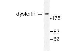 Image no. 1 for anti-Dysferlin (DYSF) antibody (ABIN265388)