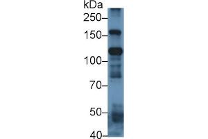 ITIH4 Antikörper  (AA 273-424)
