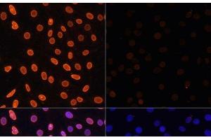 Immunofluorescence analysis of C6 cells using Acetyl-Histone H3-K36 Polyclonal Antibody at dilution of 1:100. (Histone 3 Antikörper  (acLys36))