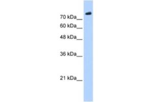 Western Blotting (WB) image for anti-PHD Finger Protein 20 (PHF20) antibody (ABIN2461244) (PHF20 Antikörper)
