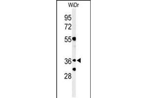 Western blot analysis of NSE4A Antibody in WiDr cell line lysates (35ug/lane) (NSMCE4A Antikörper  (N-Term))