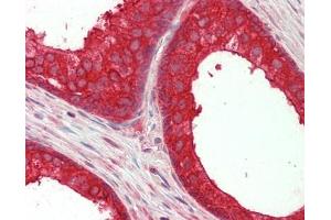 Human Prostate: Formalin-Fixed, Paraffin-Embedded (FFPE) (NEDD4-2 Antikörper  (AA 275-325))