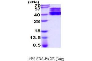 SDS-PAGE (SDS) image for ST6 beta-Galactosamide alpha-2,6-Sialyltranferase 1 (ST6GAL1) (AA 27-406) protein (His tag) (ABIN5854563) (ST6GAL1 Protein (AA 27-406) (His tag))