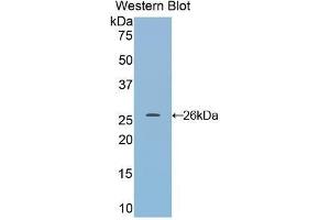 Western Blotting (WB) image for anti-Dimethylarginine Dimethylaminohydrolase 1 (DDAH1) (AA 20-215) antibody (ABIN1858614)