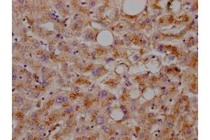 IHC image of ABIN7127599 diluted at 1:100 and staining in paraffin-embedded human liver tissue performed on a Leica BondTM system. (Rekombinanter LDLR Antikörper)