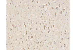 Immunohistochemistry analysis of paraffin-embedded rat brain using LC3A/B Polyclonal Antibody at dilution of 1:500. (LC3A / LC3B Antikörper)