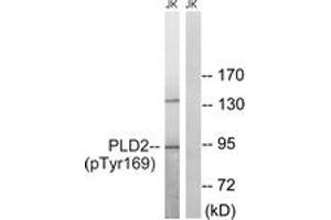 Western blot analysis of extracts from Jurkat cells treated with TNF 20ng/ml 30', using PLD2 (Phospho-Tyr169) Antibody. (Phospholipase D2 Antikörper  (pTyr169))