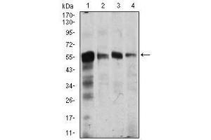 Image no. 4 for anti-Calcium/calmodulin-Dependent Protein Kinase IV (CAMK4) antibody (ABIN1491438) (CAMK4 Antikörper)