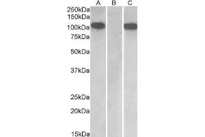HEK293 lysate (10 µg protein in RIPA buffer) overexpressing Human Furin with C-terminal MYC tag probed with ABIN1590028 (1 µg/mL) in Lane A and probed with anti-MYC Tag (1/1000) in lane C.