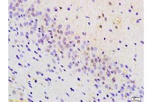 Immunohistochemistry (Paraffin-embedded Sections) (IHC (p)) image for anti-POU Domain, Class 4, Transcription Factor 1 (POU4F1) (AA 325-419) antibody (ABIN702400)