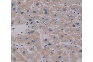 IHC-P analysis of Kidney tissue, with DAB staining. (CES1 Antikörper  (AA 18-299))