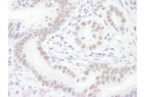 Immunohistochemistry (IHC) image for anti-Small Nuclear Ribonucleoprotein D3 Polypeptide 18kDa (SNRPD3) (AA 76-126) antibody (ABIN7454989) (SNRPD3 Antikörper  (AA 76-126))