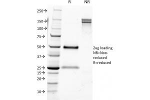 SDS-PAGE (SDS) image for anti-CD9 (CD9) antibody (ABIN6941087)