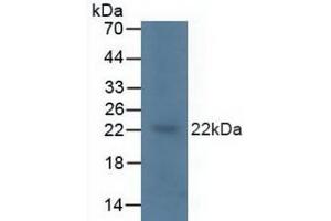 Detection of KRAS in Porcine Brain Tissue using Polyclonal Antibody to V-Ki-Ras2 Kirsten Rat Sarcoma Viral Oncogene Homolog (KRAS) (K-RAS Antikörper  (AA 1-189))
