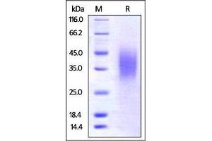 Mouse BTLA, His Tag on SDS-PAGE under reducing (R) condition. (BTLA Protein (AA 30-176) (His tag))