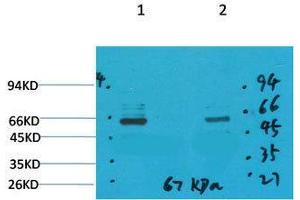 Western Blot (WB) analysis of 1) Mouse Brain Tissue, 2)Rat Brain Tissue with GABA Transporter 1 Rabbit Polyclonal Antibody diluted at 1:2000. (SLC6A1 Antikörper)