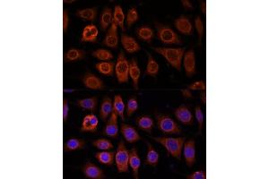 Immunofluorescence analysis of L929 cells using TMEM11 antibody (ABIN7270952) at dilution of 1:100. (TMEM11 Antikörper  (AA 1-80))