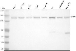 Western blot analysis of CYFIP1 using anti-CYFIP1 antibody (ABIN7604562).