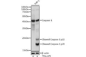 Immunohistochemistry of paraffin-embedded human colon using Caspase-1 Rabbit pAb (ABIN3021170, ABIN3021171, ABIN3021172 and ABIN6214049) at dilution of 1:100 (40x lens). (Caspase 1 Antikörper  (AA 1-311))