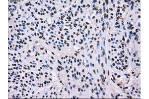 Image no. 2 for anti-L1 Cell Adhesion Molecule (L1CAM) antibody (ABIN1499084)