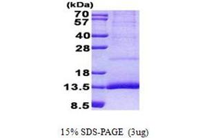SDS-PAGE (SDS) image for Cystatin 11 (CST11) (AA 26-103) protein (His tag) (ABIN5852992)