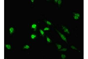Immunofluorescent analysis of Hela cells using ABIN7172224 at dilution of 1:100 and Alexa Fluor 488-congugated AffiniPure Goat Anti-Rabbit IgG(H+L) (TM2D3 Antikörper  (AA 31-153))