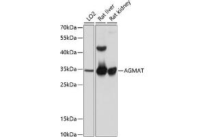 Western blot analysis of extracts of various cell lines, using AGMAT antibody (ABIN6131218, ABIN6136634, ABIN6136635 and ABIN6215786) at 1:1000 dilution. (AGMAT Antikörper  (AA 1-352))