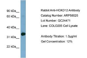 WB Suggested Anti-HOXD12  Antibody Titration: 0. (HOXD12 Antikörper  (Middle Region))
