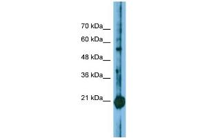 Host: Rabbit Target Name: CBFB Sample Type: Jurkat Whole Cell lysates Antibody Dilution: 1. (CBFB Antikörper  (N-Term))