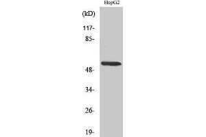 Western Blotting (WB) image for anti-Cytochrome P450, Family 26, Subfamily A, Polypeptide 1 (CYP26A1) (Internal Region) antibody (ABIN3179989) (CYP26A1 Antikörper  (Internal Region))
